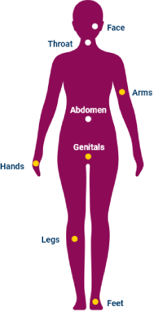 image of common body locations